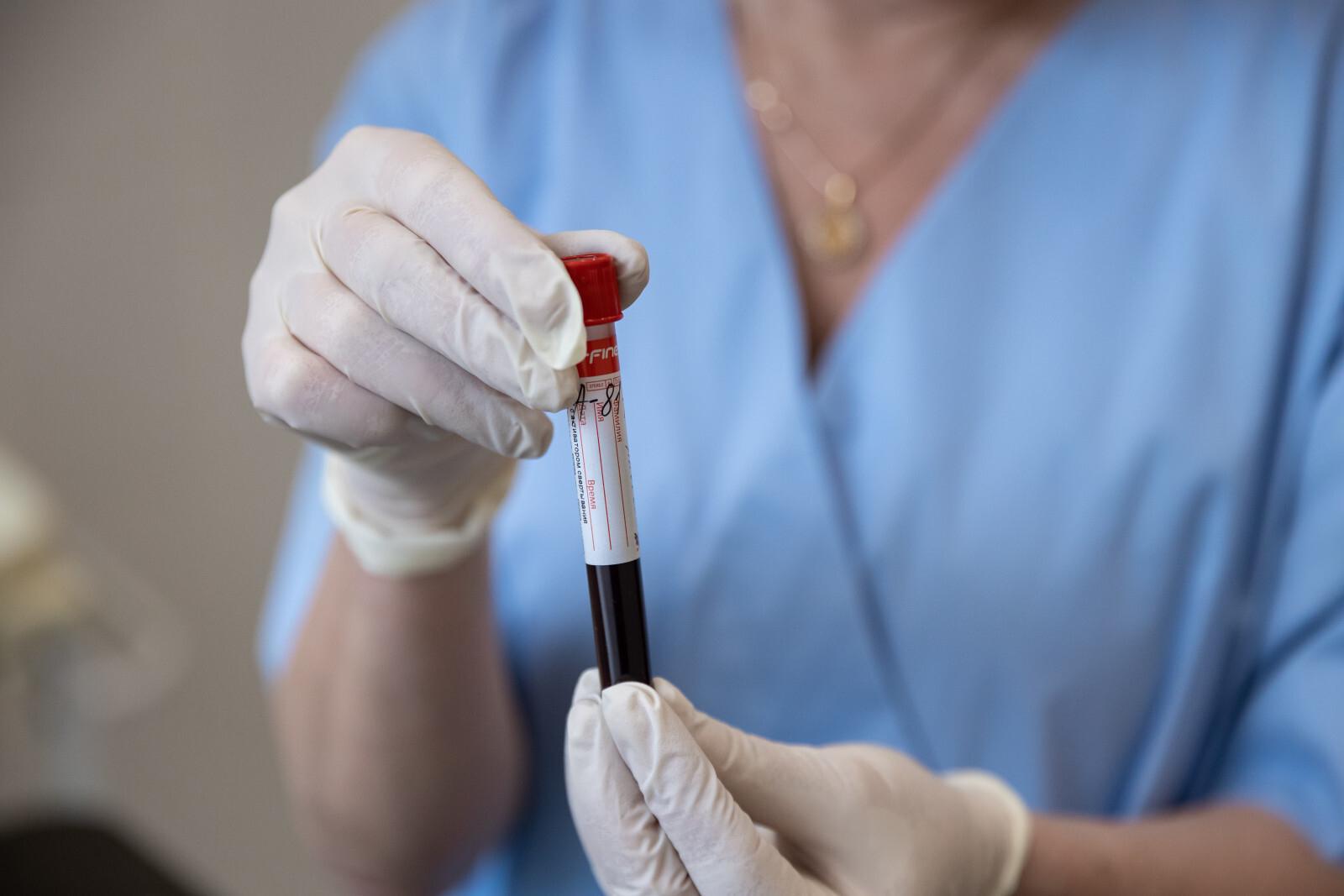 В России разработали новый ПЦР‑тест для диагностики хеликобактериоза