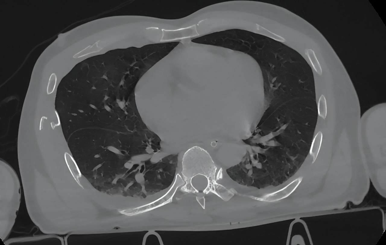 Удалили селезенку, ушили печень и кишечник: в Петербурге вытащили с того света пострадавшего в ДТП
