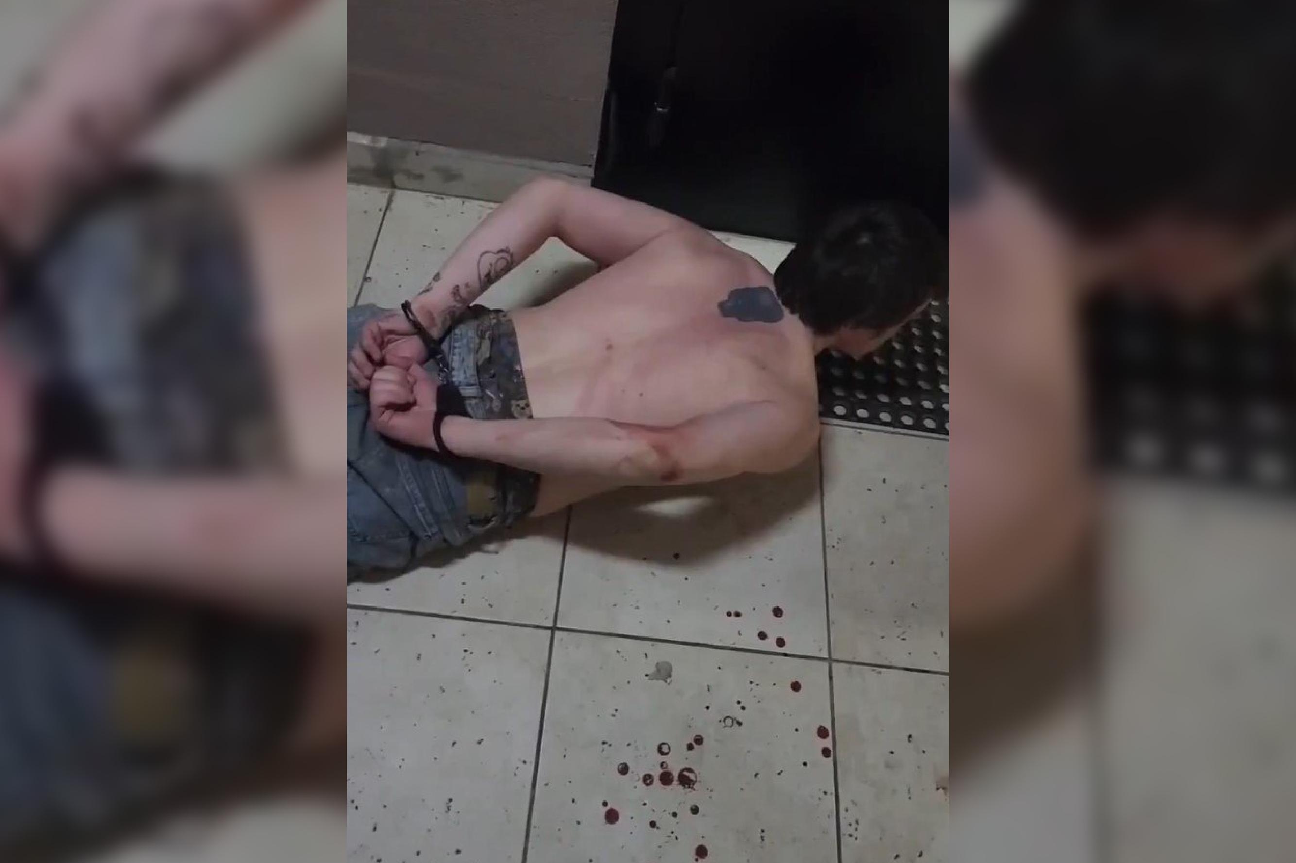 Пьяный мужчина несколько раз ударил ножом в затылок свою сожительницу в Петербурге