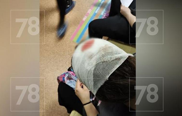 В Петербурге подросток метнул кирпич в голову школьнице