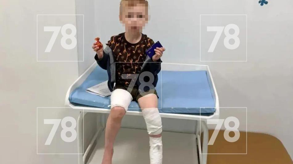 Во Всеволожском районе бультерьер набросился на 4-летнего мальчика